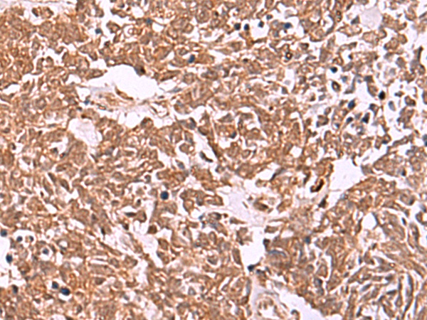 IRX5 Antibody