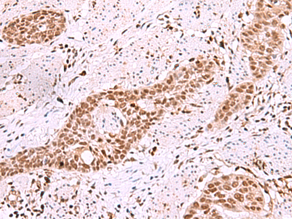 ISL2 Antibody