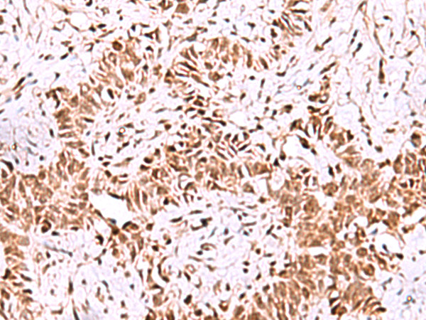 ISY1-RAB43 Antibody