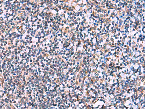 NMRK2 Antibody