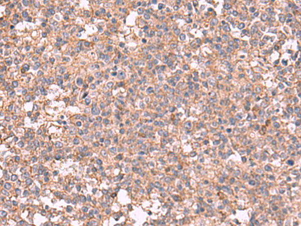 MAPK8IP3 Antibody