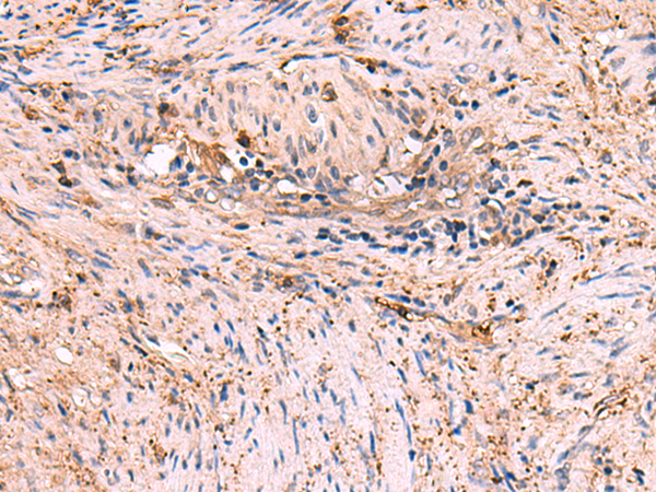 MAPK8IP3 Antibody