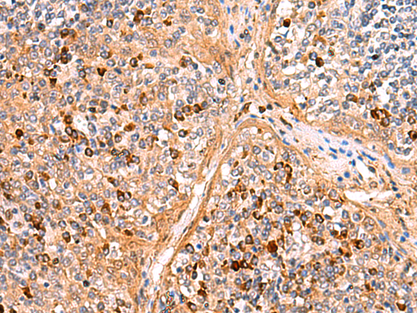 KANSL1L Antibody