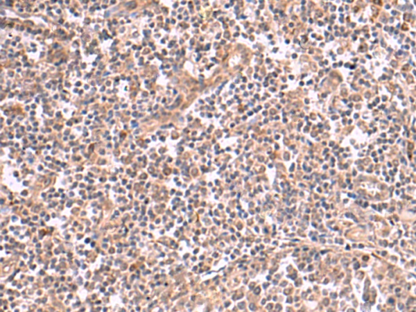 SLC12A7 Antibody