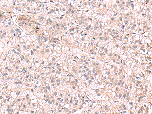 KCNK18 Antibody