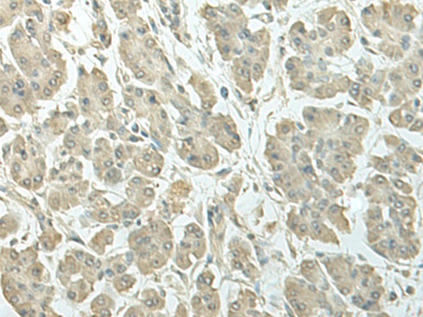 SPIRE1 Antibody