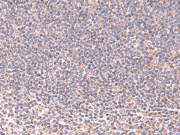 MANSC1 Antibody