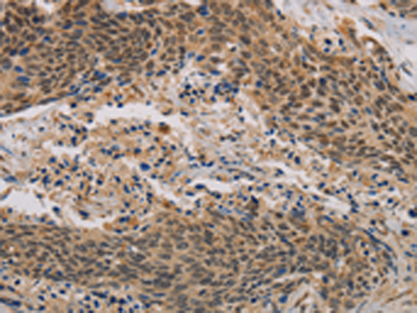 CLEC5A Antibody