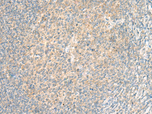 ADGRF5 Antibody