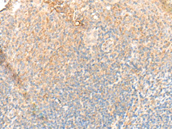 PTGDR2 Antibody