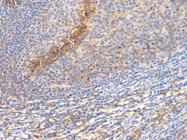 GPR142 Antibody