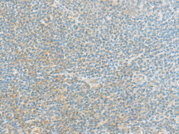 FAM171A2 Antibody