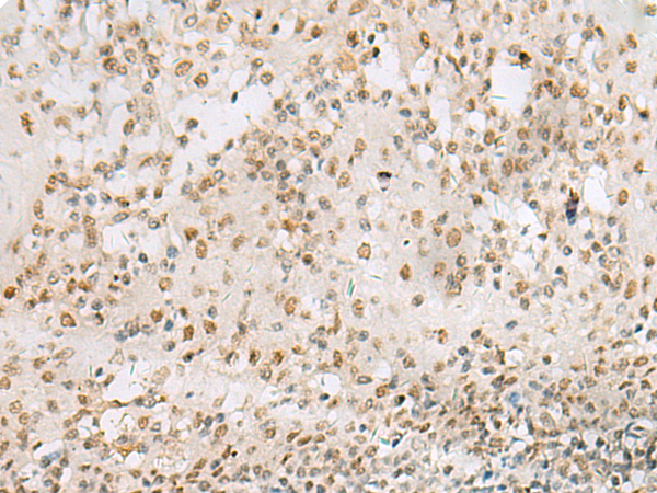 HNRNPA1L2 Antibody