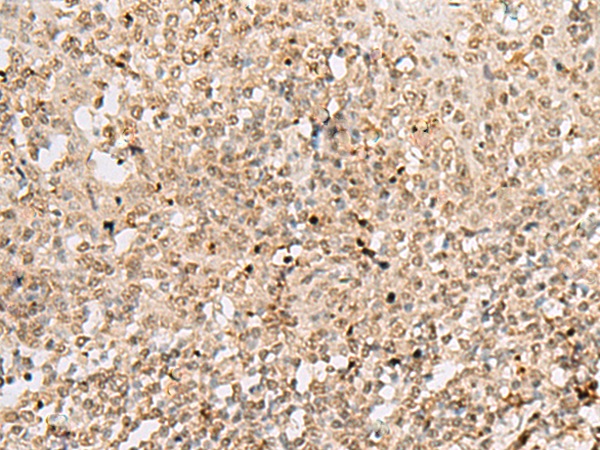 HNRNPCL1 Antibody