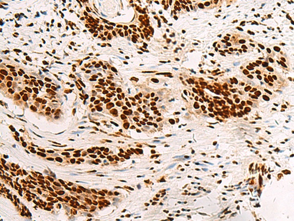 HNRNPA3 Antibody