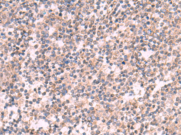 KCNK2 Antibody