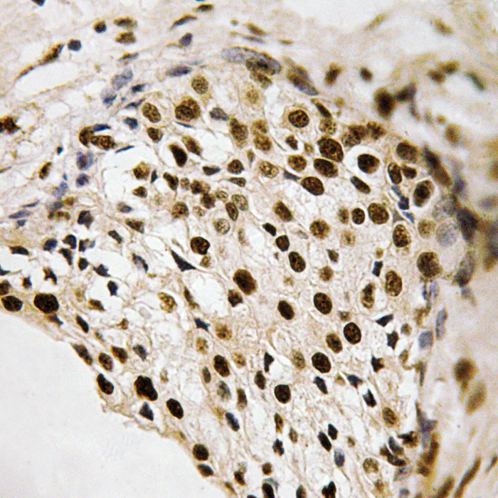 PRAK (phospho-Thr182) Antibody