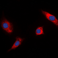 RSK1/2/3 (phospho-Thr573/570/577) Antibody