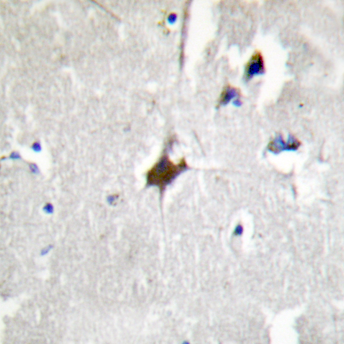 KLHL3 Antibody