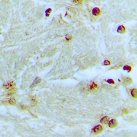 MED13L Antibody