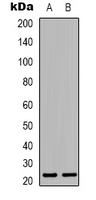 MRPL22 Antibody