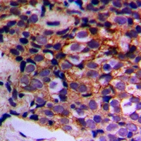 MTIF3 Antibody