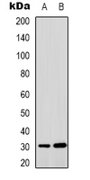 MTIF3 Antibody