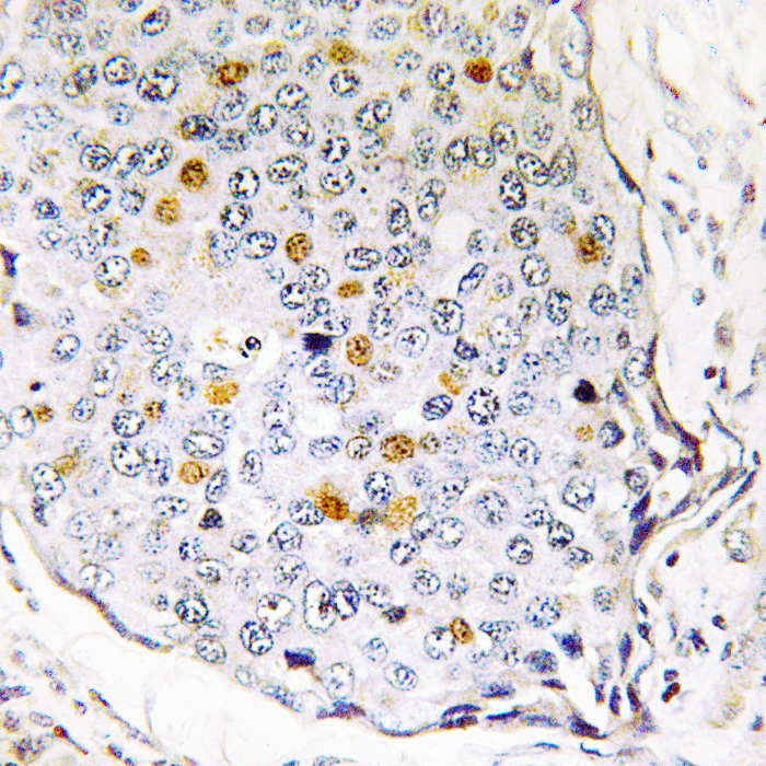 RPS27L Antibody