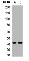 Kappa Opioid Receptor Antibody