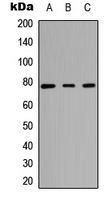 CARK Antibody