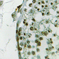 Ubiquilin 3 Antibody