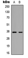 MARCH5 Antibody