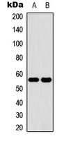 Cytochrome P450 2C19 Antibody