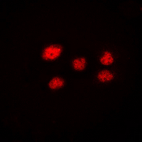 VPS72 Antibody