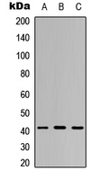 VPS72 Antibody