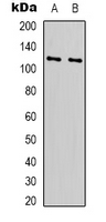 RPS6KC1 Antibody