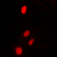 TP53INP2 Antibody