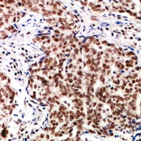 TP53INP2 Antibody