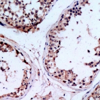 CHST9 Antibody