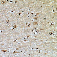 ZNRF2 Antibody