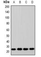 ZNRF2 Antibody