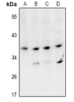 VPS26B Antibody