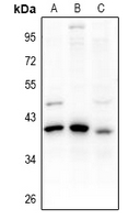 PDIK1L Antibody