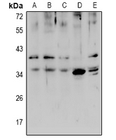 ZIP1 Antibody