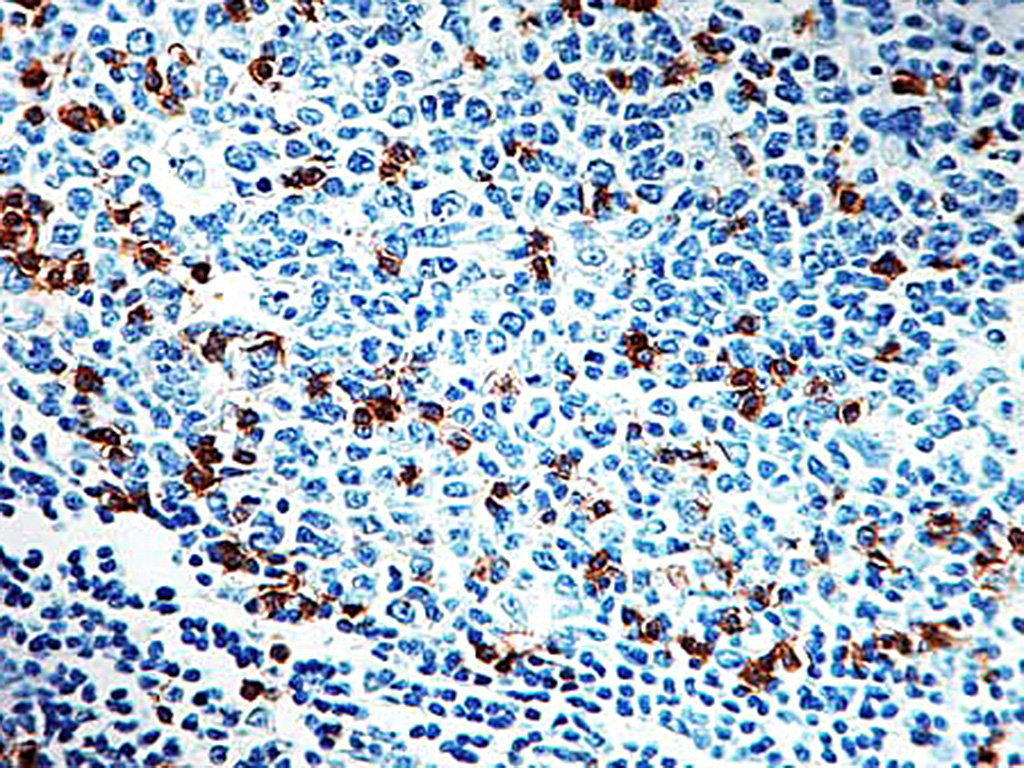 CD57 Antibody