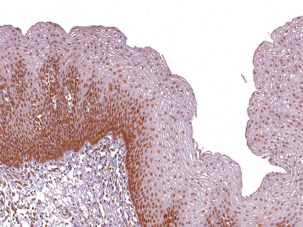 MSH2 Antibody