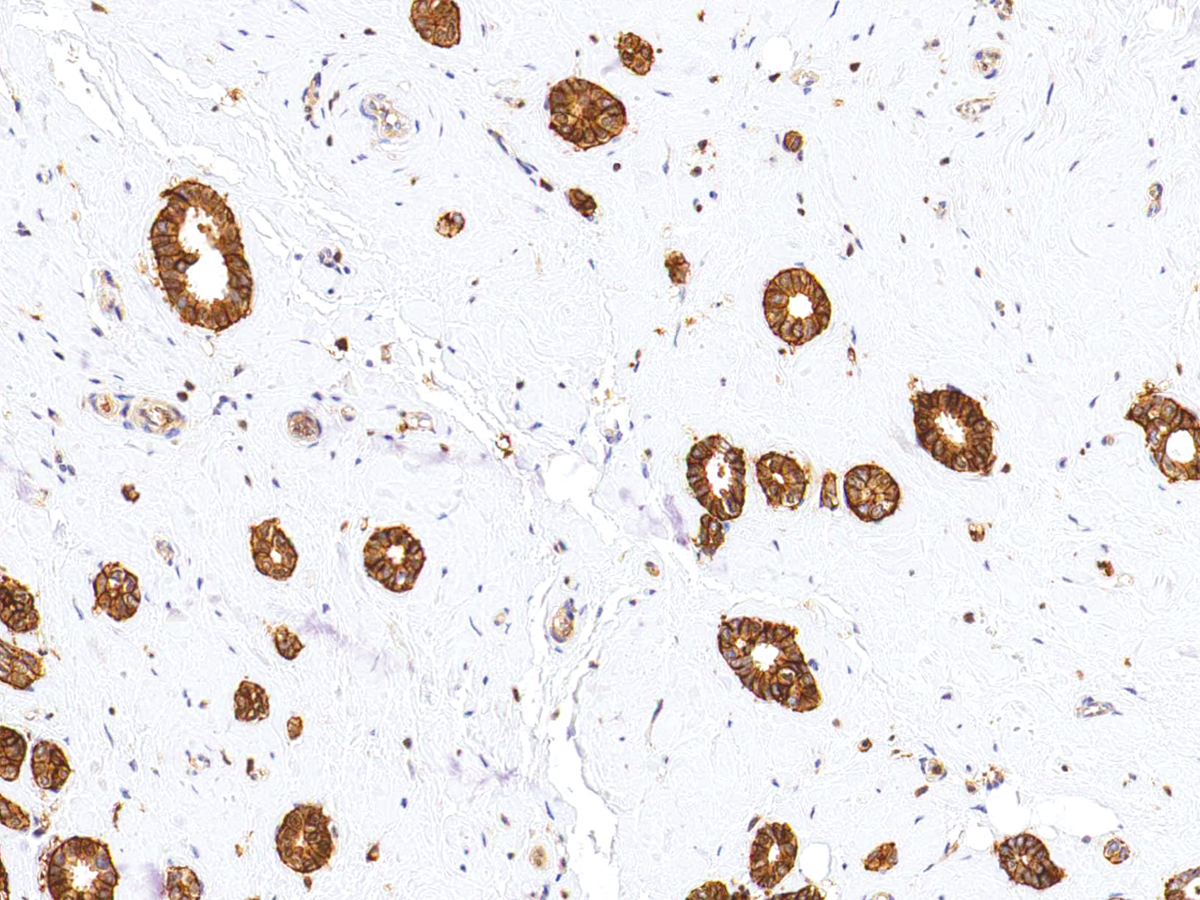 CD44 Antibody