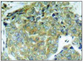 eIF-2a (Phospho-Ser 52) Antibody