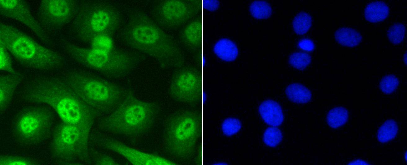 Phospho-Smad5(S463/465) Rabbit mAb