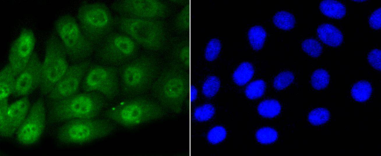 Phospho-Smad5(S463/465) Rabbit mAb